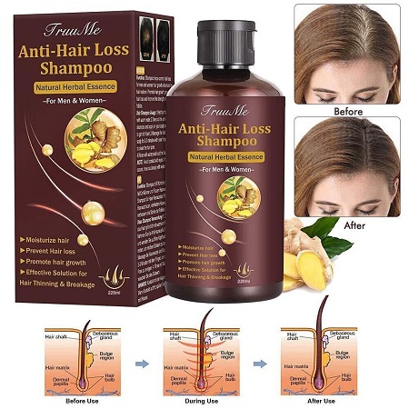 anti hair loss shampoo 04 - شامپو ریزش مو چیست؟ آیا واقعا تاثیر دارد؟