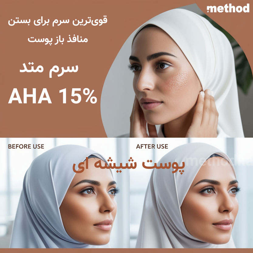 AHA 15 متد قوی‌ترین سرم برای بستن منافذ باز پوست و دستیابی به پوستی صاف و شفاف - سرم AHA 15% متد: قوی‌ترین سرم برای بستن منافذ باز پوست و دستیابی به پوستی صاف و شفاف