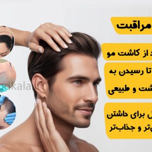 بعد از کاشت مو گام به گام تا رسیدن به موهای پرپشت و طبیعی 300x300 - صفحه نخست