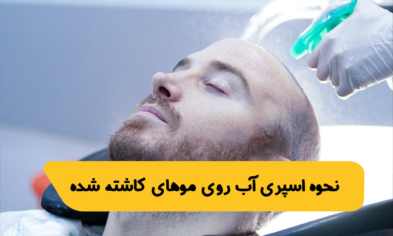 نحوه اسپری آب روی موهای کاشته شده