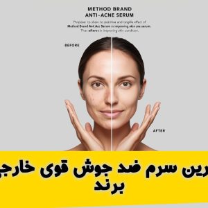 سرم ضد جوش قوی خارجی برند متد 300x300 - صفحه نخست