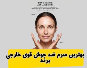 بهترین سرم ضد جوش قوی خارجی برند متد|method