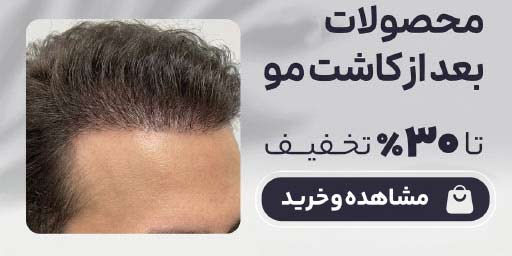 کاشت مو 1 - صفحه نخست